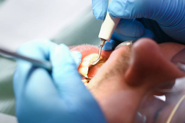 Best Emergency TMJ Treatment in Oxford, OH