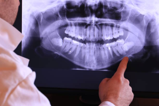 Best Urgent Care for Lost Fillings or Crowns in Oxford, OH